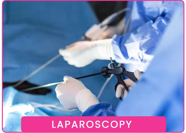 Laparoscopy