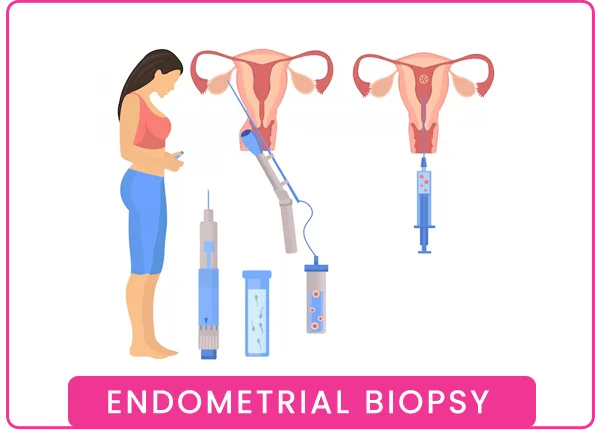 Endometrial Biopsy